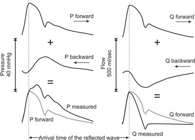 Arterial Wave Reflection and Aortic Valve Stenosis: Diagnostic Challenges and Prognostic Significance